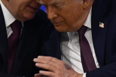 ABD Başkanı Trump'ın elinde görülen morluk dikkat çekti