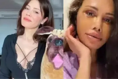 DİDEM CERAN'IN SON HALİ: Didem Ceran yüz nakli mi oldu, son hali nasıl?