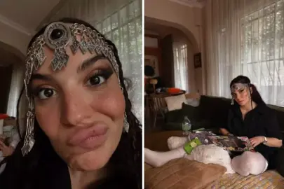 Yanlışlıkla bağırsağı kesilen Aslı Bekiroğlu son durumunu paylaştı