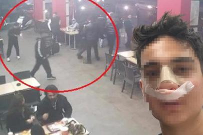 Antalya'da akran dehşeti! "Neden bakıyorsun" deyip burnunu kırdılar