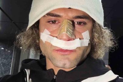 Elazığspor’da Fuat Bavuk’un burnu kırıldı