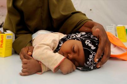 Nijerya'da kızamık salgını. 15 çocuk hayatını kaybetti