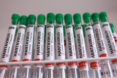 Fransa Sağlık Bakanlığı: Hantavirüslü yolcunun durumu kötüleşiyor