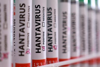 Hantavirüs paniği. Hollandalı kabin memurunun testi negatif çıktı